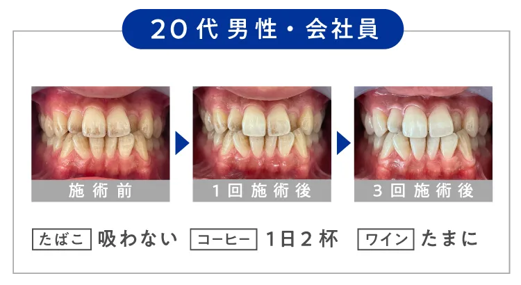 ＼  ３０代 男性・会社員 ／【 たばこ 】吸わない 【 コーヒー 】１日２杯 【 ワイン 】たまに