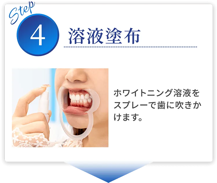 step04 溶液塗布 ホワイトニング溶液をスプレーで歯に吹きかけます。