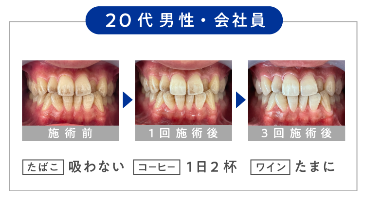 ＼  ３０代 男性・会社員 ／【 たばこ 】吸わない 【 コーヒー 】１日２杯 【 ワイン 】たまに