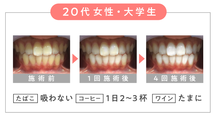 ＼ ２０代 女性・大学生 ／【 たばこ 】吸わない 【 コーヒー 】１日２～３杯 【 ワイン 】たまに