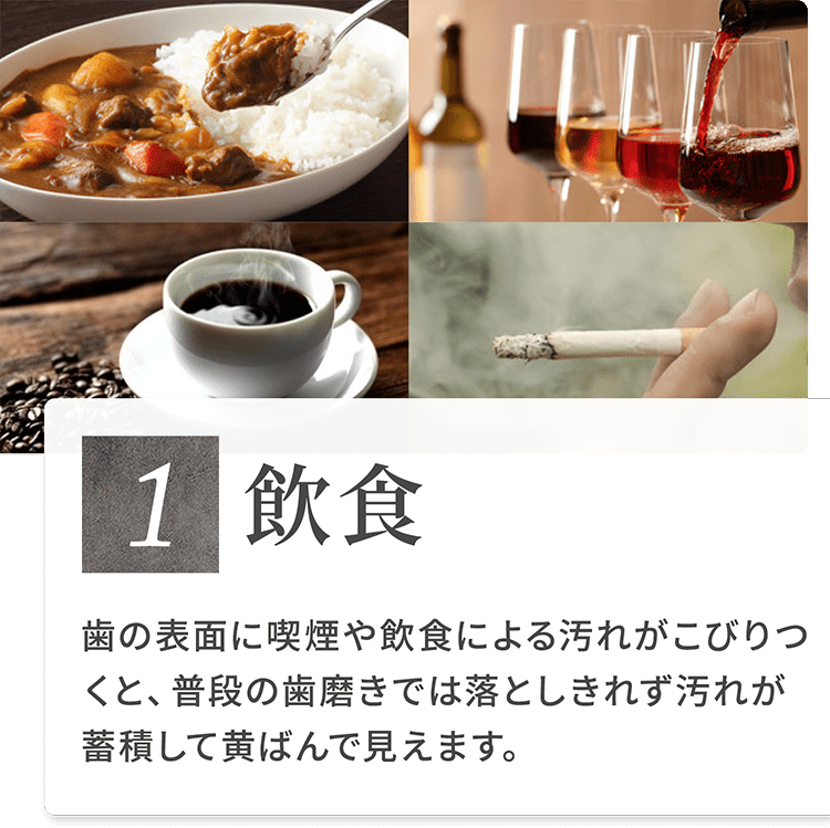 1）飲食 歯の表面に喫煙や飲食による汚れがこびりつくと、普段の歯磨きでは落としきれず汚れが蓄積して黄ばんで見えます。