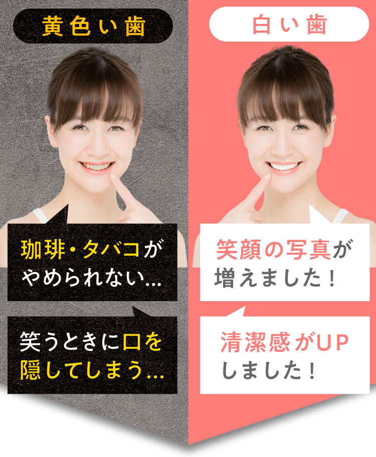 印象 歯の白さに自信はありますか？